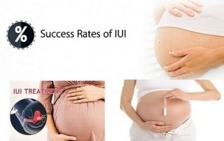 how many iui